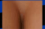 Boobs, Butt, or Shoulder?